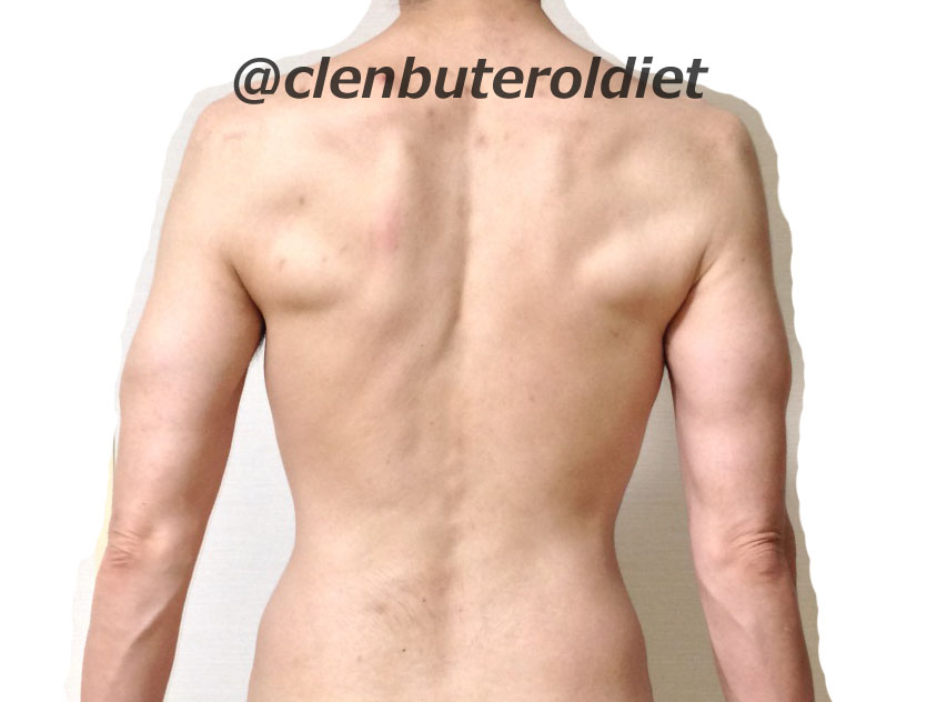f:id:clenbuteroldiet:20170730022756j:plain
