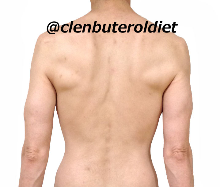 f:id:clenbuteroldiet:20170811202306j:plain