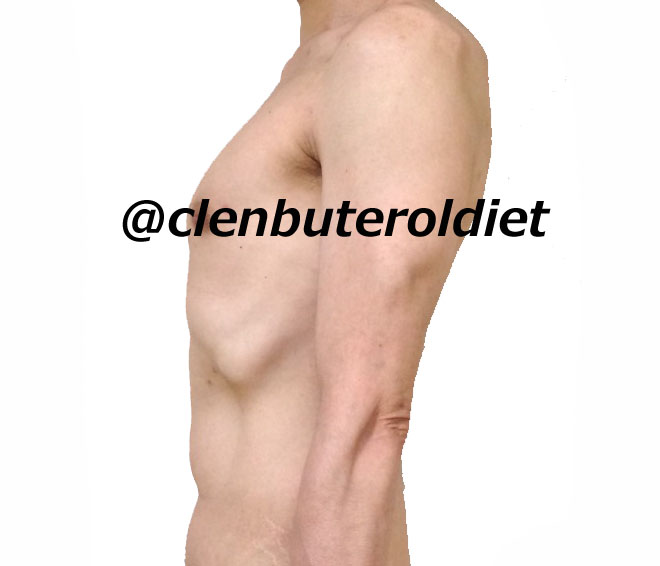 f:id:clenbuteroldiet:20170811202336j:plain