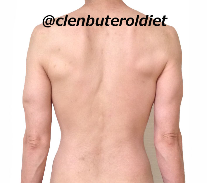 f:id:clenbuteroldiet:20170825234100j:plain