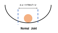 f:id:clinical-reasoning_detective-pt:20191202214210p:plain