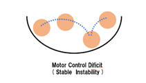 f:id:clinical-reasoning_detective-pt:20191202214305p:plain