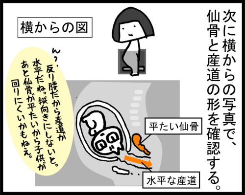 無料ダウンロード 臨月 骨盤 レントゲン 最優秀作品賞