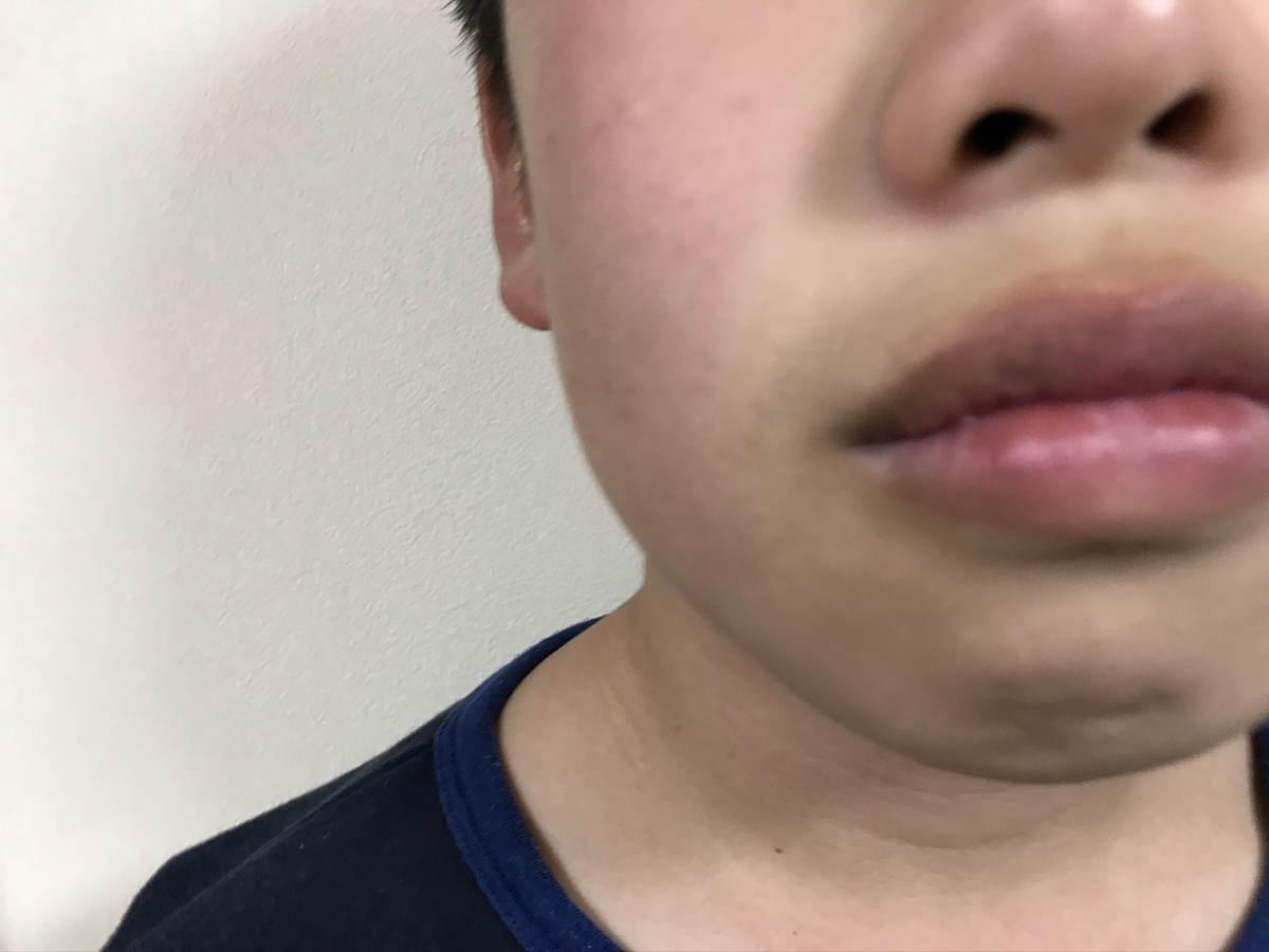 f:id:cobumaki:20200418152157j:plain