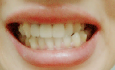 f:id:coconecosan:20181112102834j:plain f:id:coconecosan:20181112102834j:plain