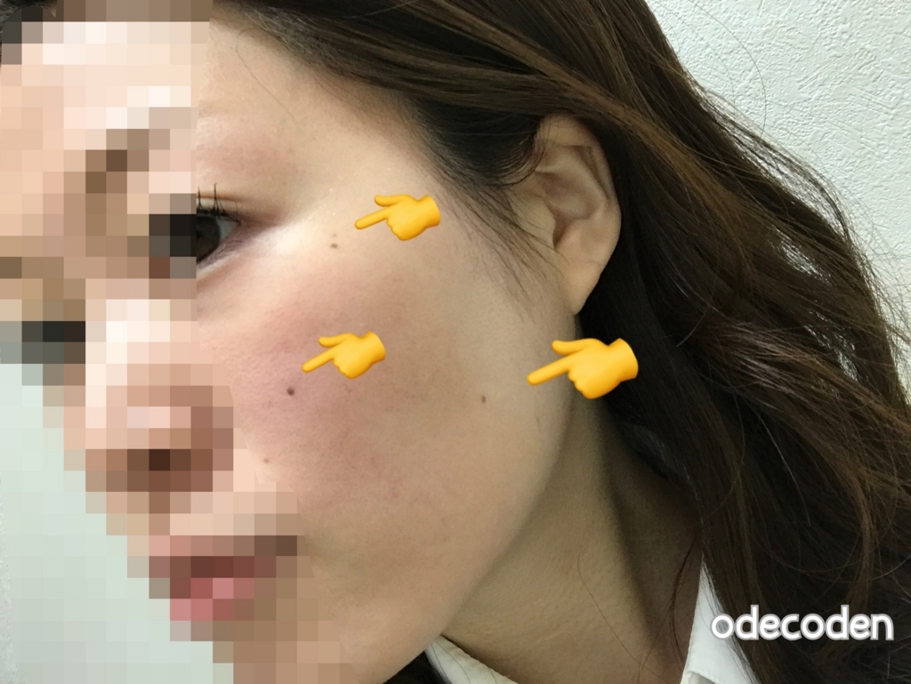 f:id:coden:20180119163814j:plain f:id:coden:20180119163814j:plain