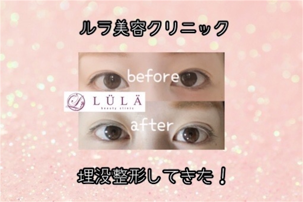 f:id:coden:20210725114328j:image