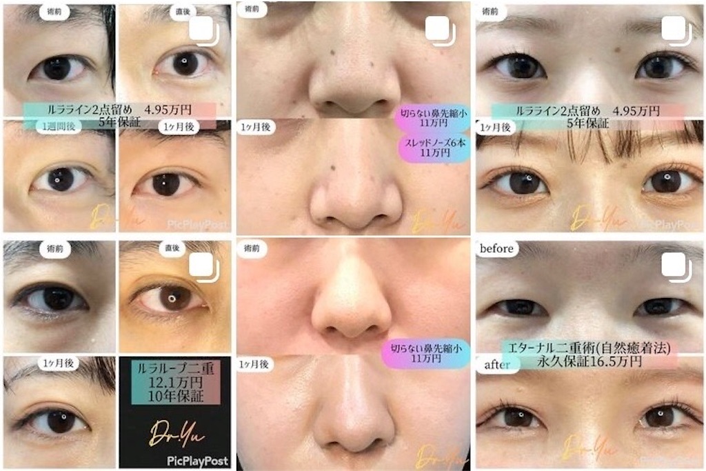 f:id:coden:20210725114341j:plain