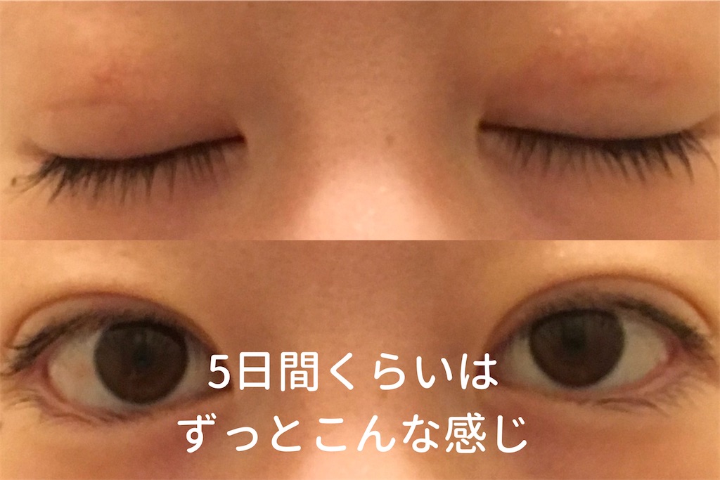 f:id:coden:20210725114531j:plain