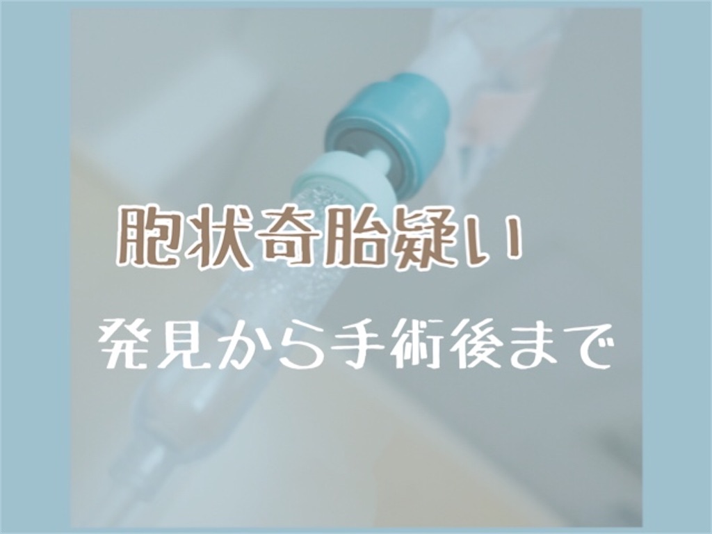 f:id:comeko:20200208141015j:image