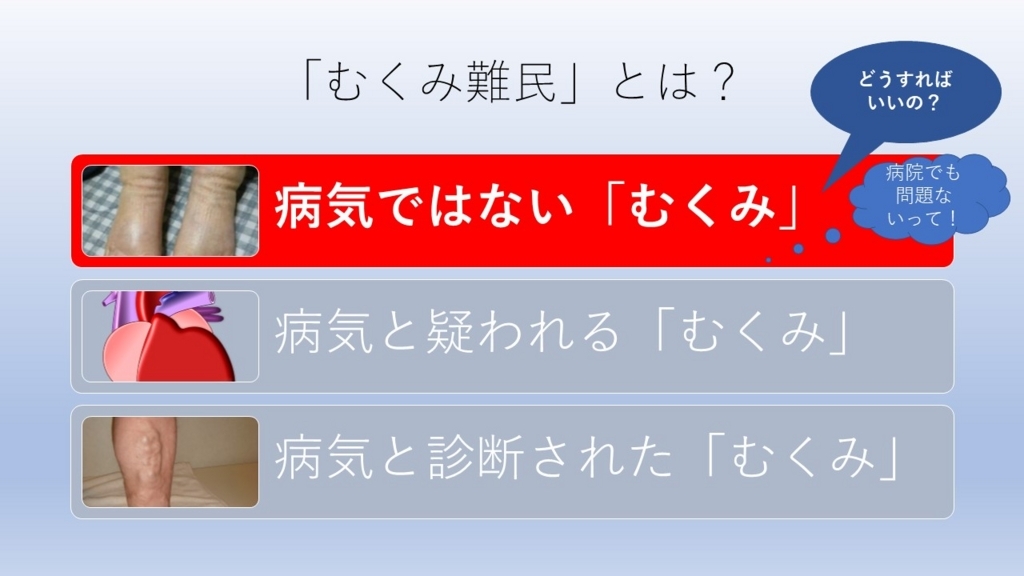 f:id:compressionstocking:20180819012609j:plain