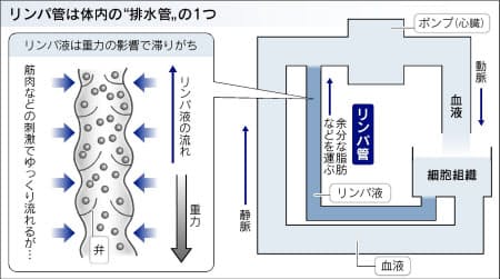 f:id:compressionstocking:20180819212209j:plain