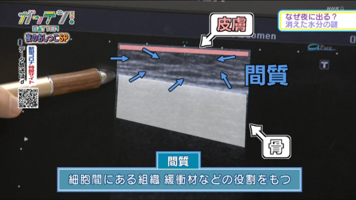 f:id:compressionstocking:20201019064422p:plain