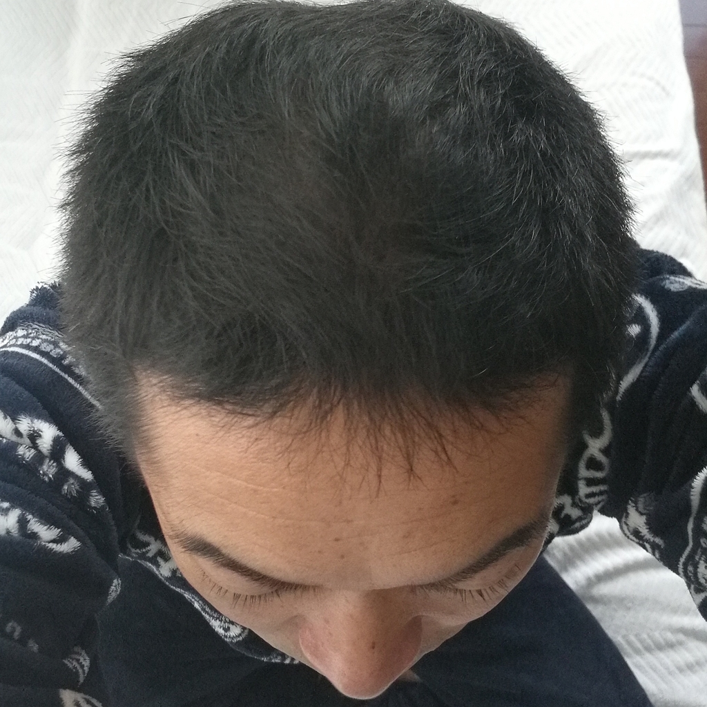 f:id:corryvreckan:20181116071337j:plain