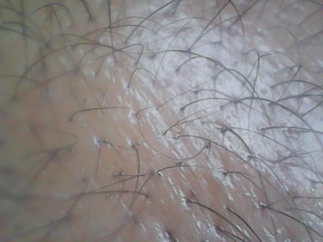 f:id:corryvreckan:20181126104445j:plain