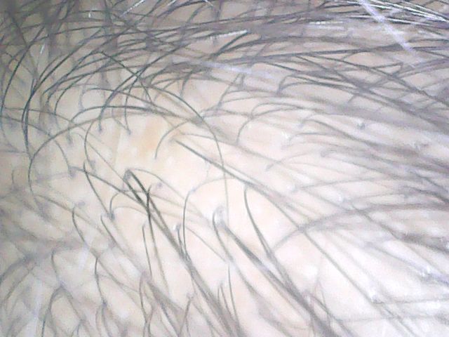 f:id:corryvreckan:20181126104846j:plain