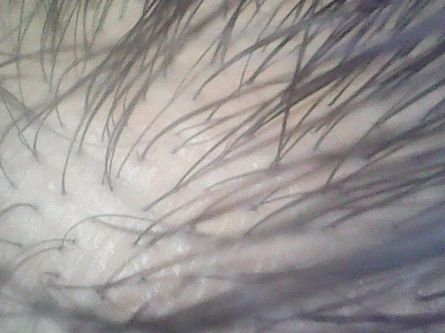 f:id:corryvreckan:20181126105127j:plain