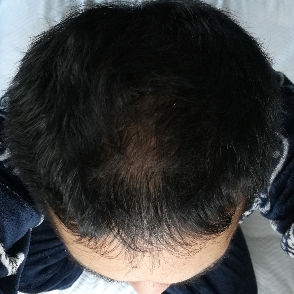 f:id:corryvreckan:20181128075949j:plain
