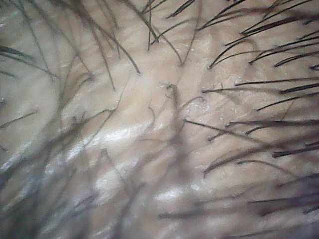 f:id:corryvreckan:20181217135132j:plain