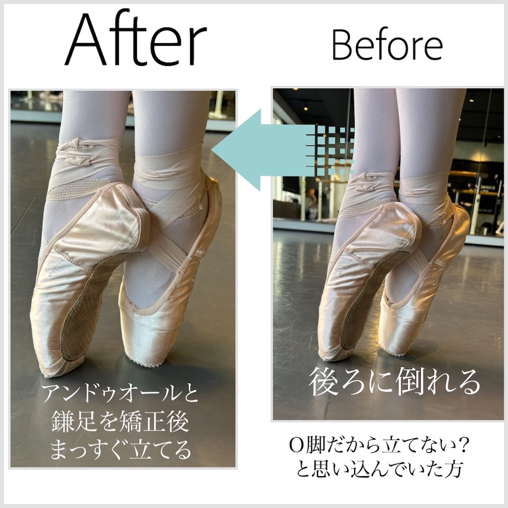 トウシューズが後ろに倒れるのはなぜ？ - 森のバレエヨガ - 三科絵理
