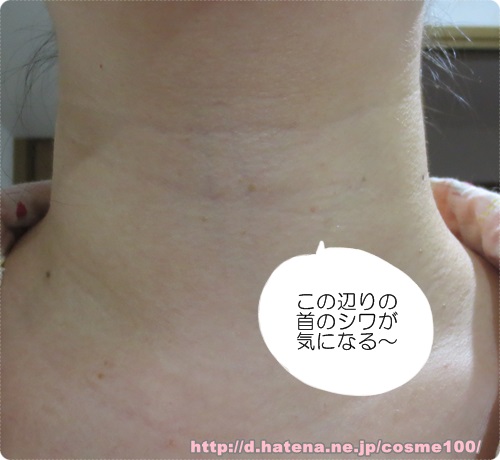 首のシワが消えてきた 私の方法はララルーチュっていう美顔器を使ったんだ 時短コスメの口コミナビ