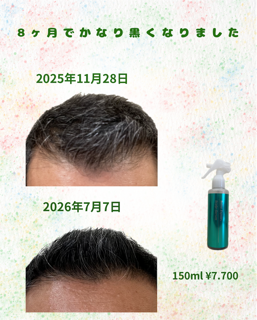 f:id:creerbiyou:20260814095543p:image