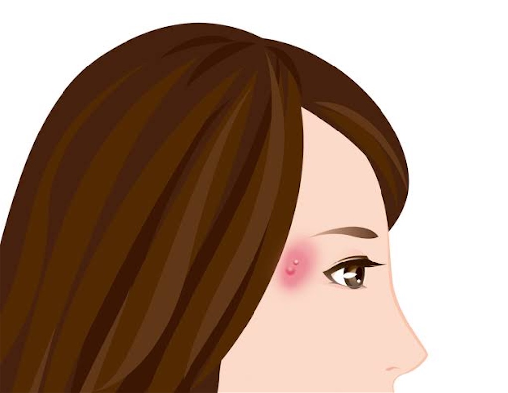 f:id:cskk:20200613140839j:image