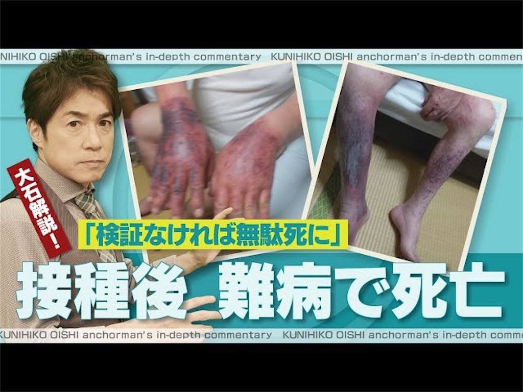 f:id:cuespot_331:20240916211746j:image