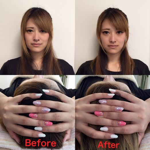 一度で必ず小顔を実感 94 5 がリピートする痛くない小顔矯正 小顔きゅっと 中目黒 Cuttokogaoのブログ