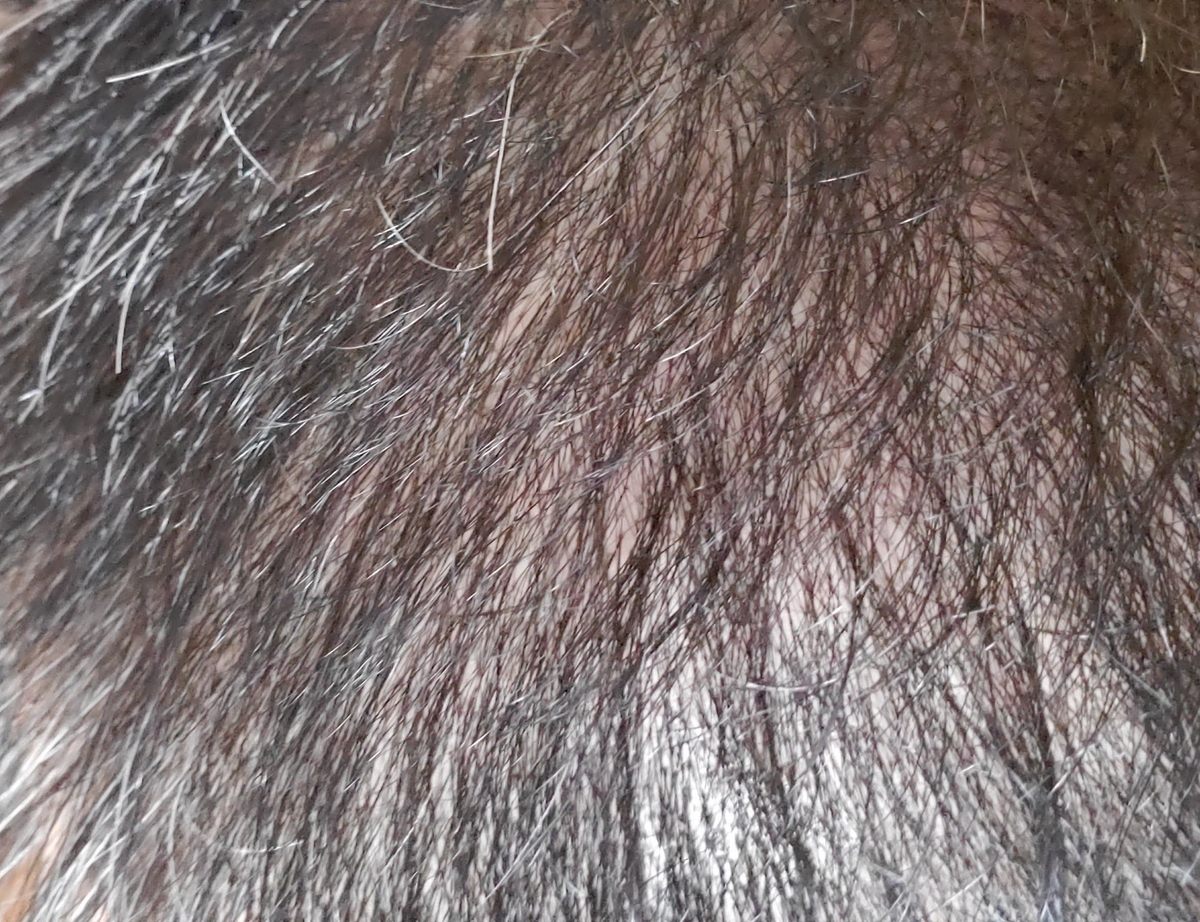 40代でスキンヘッド