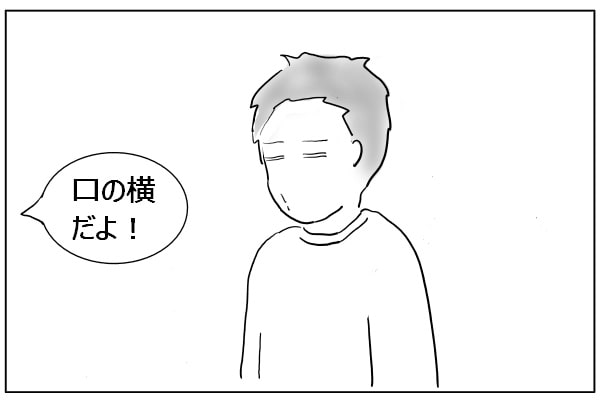 顔の傷