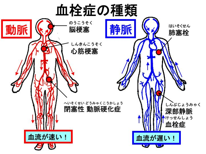 f:id:daikous:20200505111323p:plain