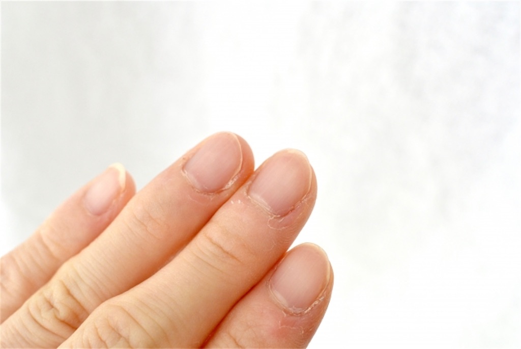 爪の凹凸 ネイルカラーが綺麗に塗れない 原因と治し方 おすすめのケア用品 Y Beauty