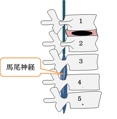 f:id:darucoro9216kun:20210227164005p:plain