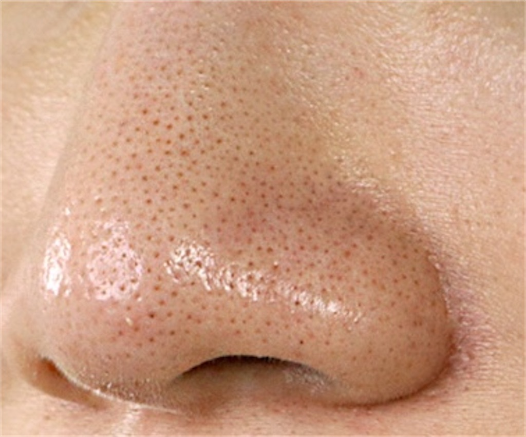 f:id:datsuhadasagi:20210320001144j:image f:id:datsuhadasagi:20210320001144j:image