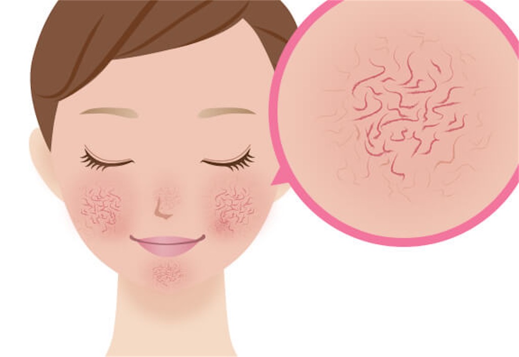 f:id:datsuhadasagi:20210320013209j:image f:id:datsuhadasagi:20210320013209j:image