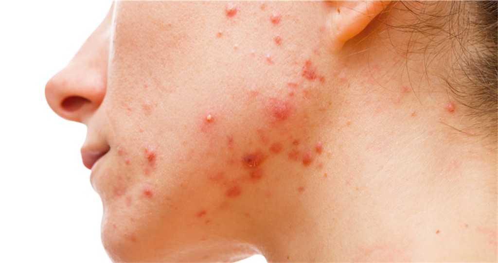 f:id:datsuhadasagi:20210510002540j:image