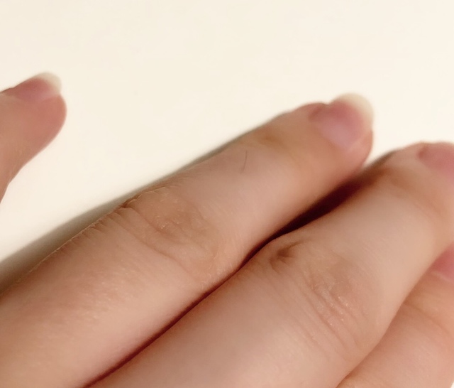 こんなところに毛 左手薬指 第一関節から第二関節の間