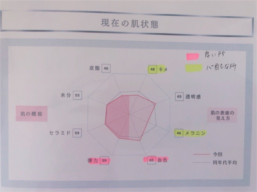 f:id:ddbpxj:20190120111240j:image