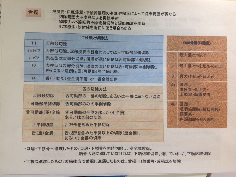 f:id:dekaidecay:20120715171848j:image