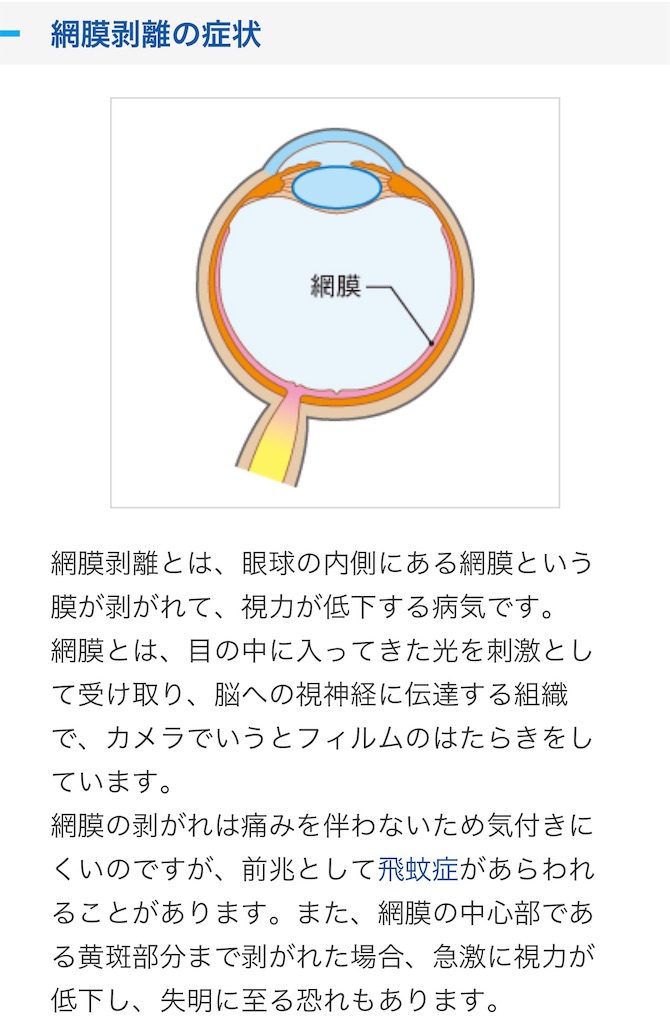 f:id:dencolife_com:20181125115829j:image