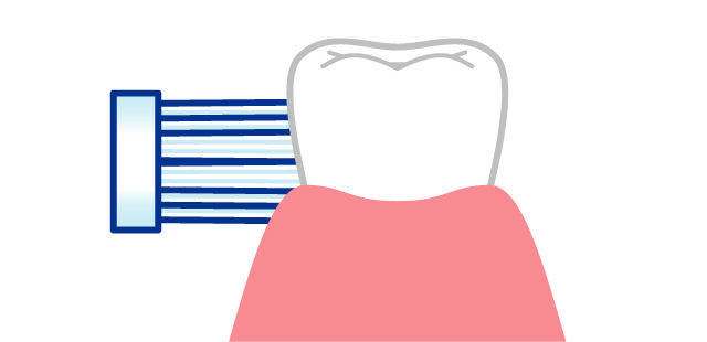 f:id:dental_sarah:20190807183813j:plain