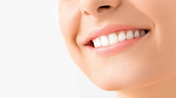What do you need to pay attention to after tooth whitening?