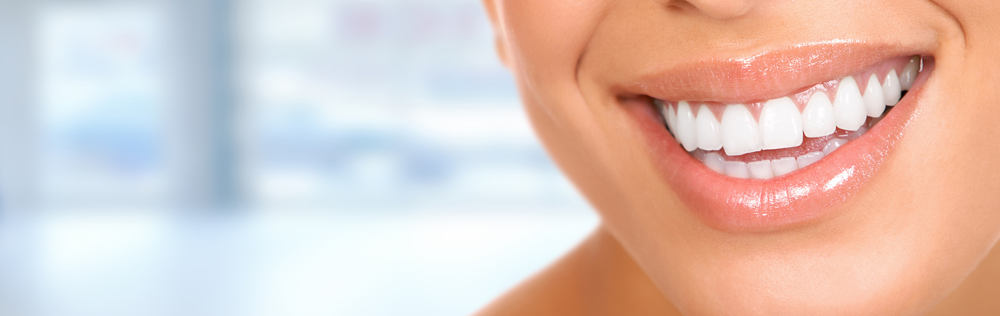 f:id:dentaldeals:20170317192310p:plain