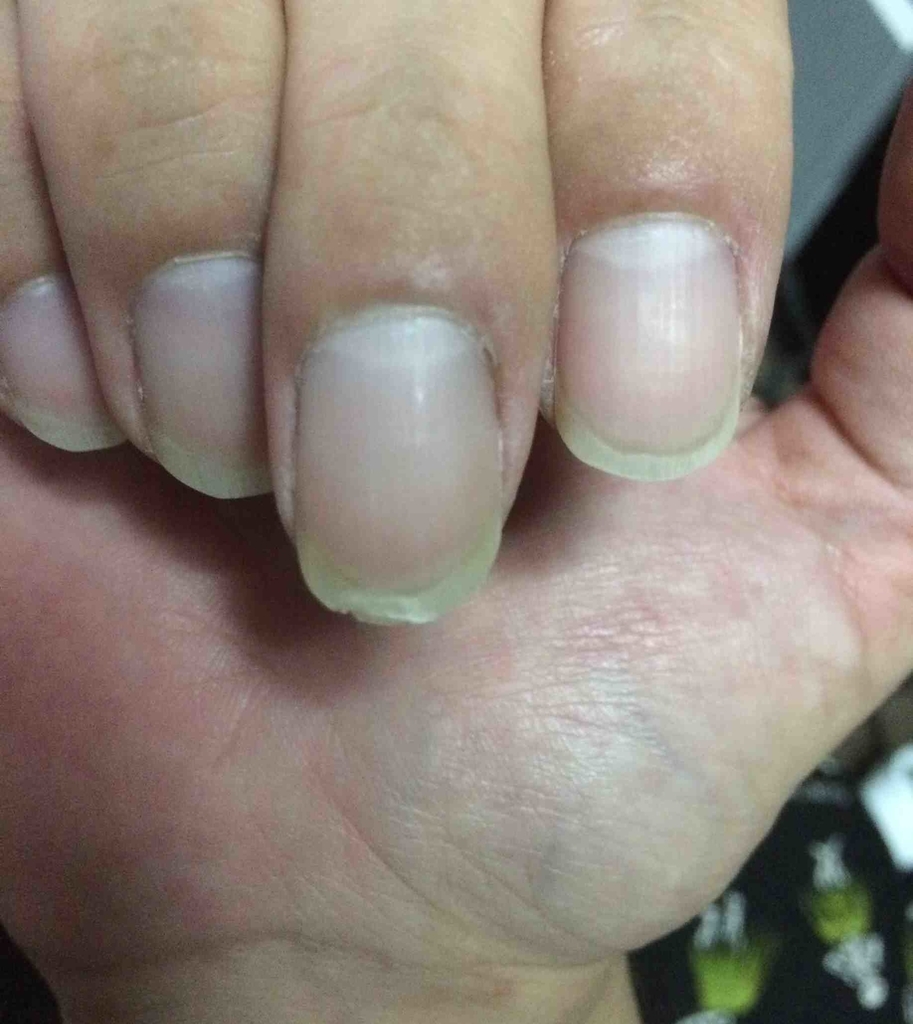 f:id:deokisikun:20181017233601j:plain