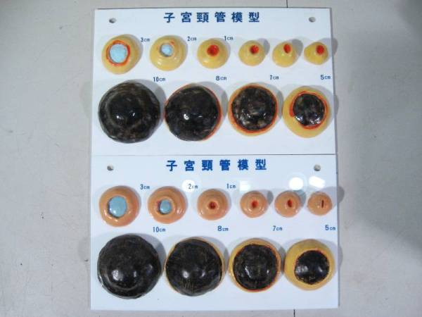 妊娠 出産を通して知った 人間の体の驚き でらぁのーと