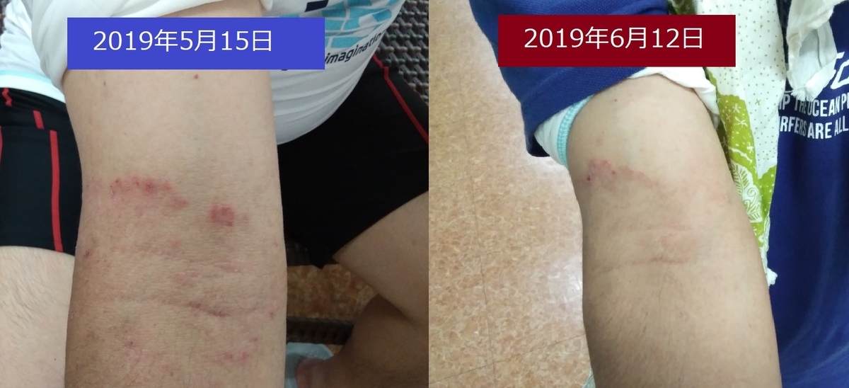 f:id:detox-advisor:20190614060404j:plain f:id:detox-advisor:20190614060404j:plain