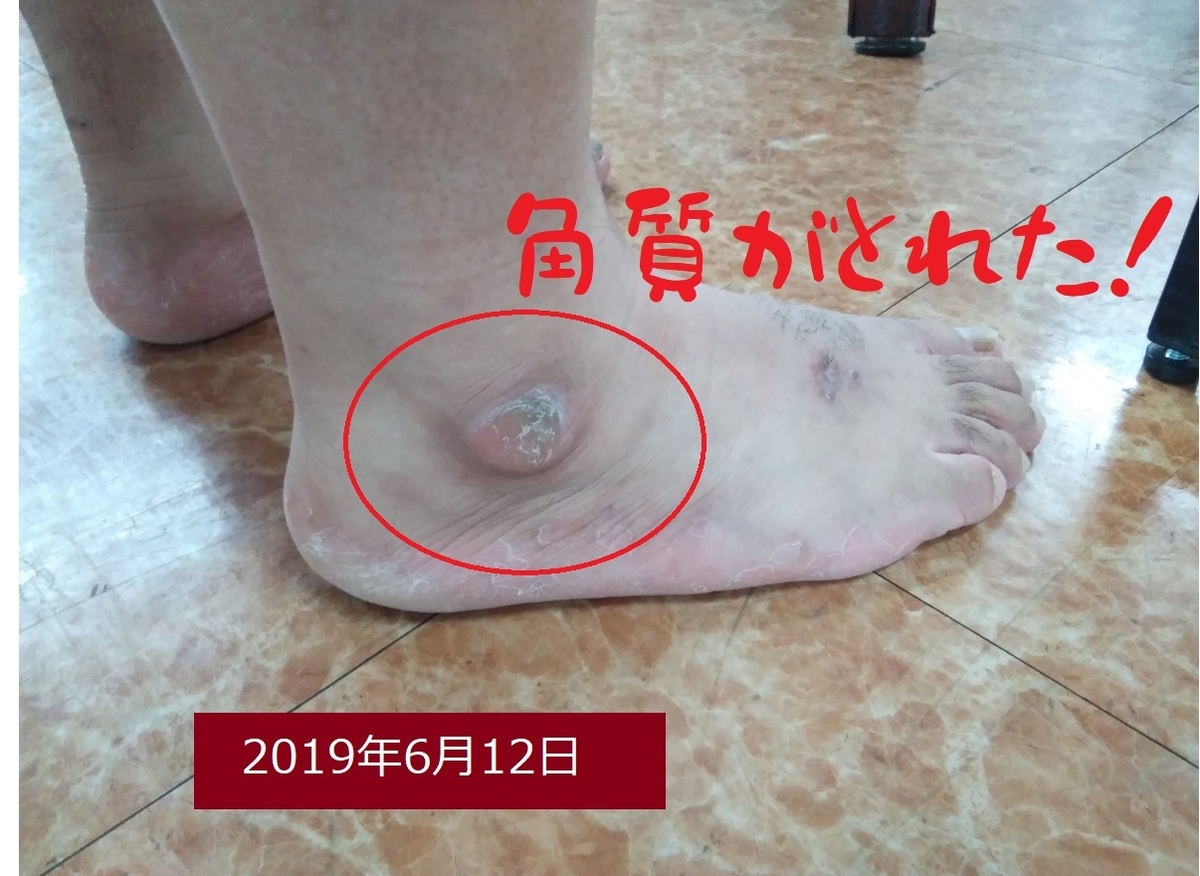 f:id:detox-advisor:20190614061956j:plain f:id:detox-advisor:20190614061956j:plain