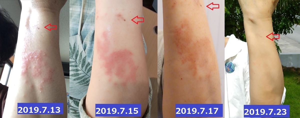 f:id:detox-advisor:20190723215342j:plain