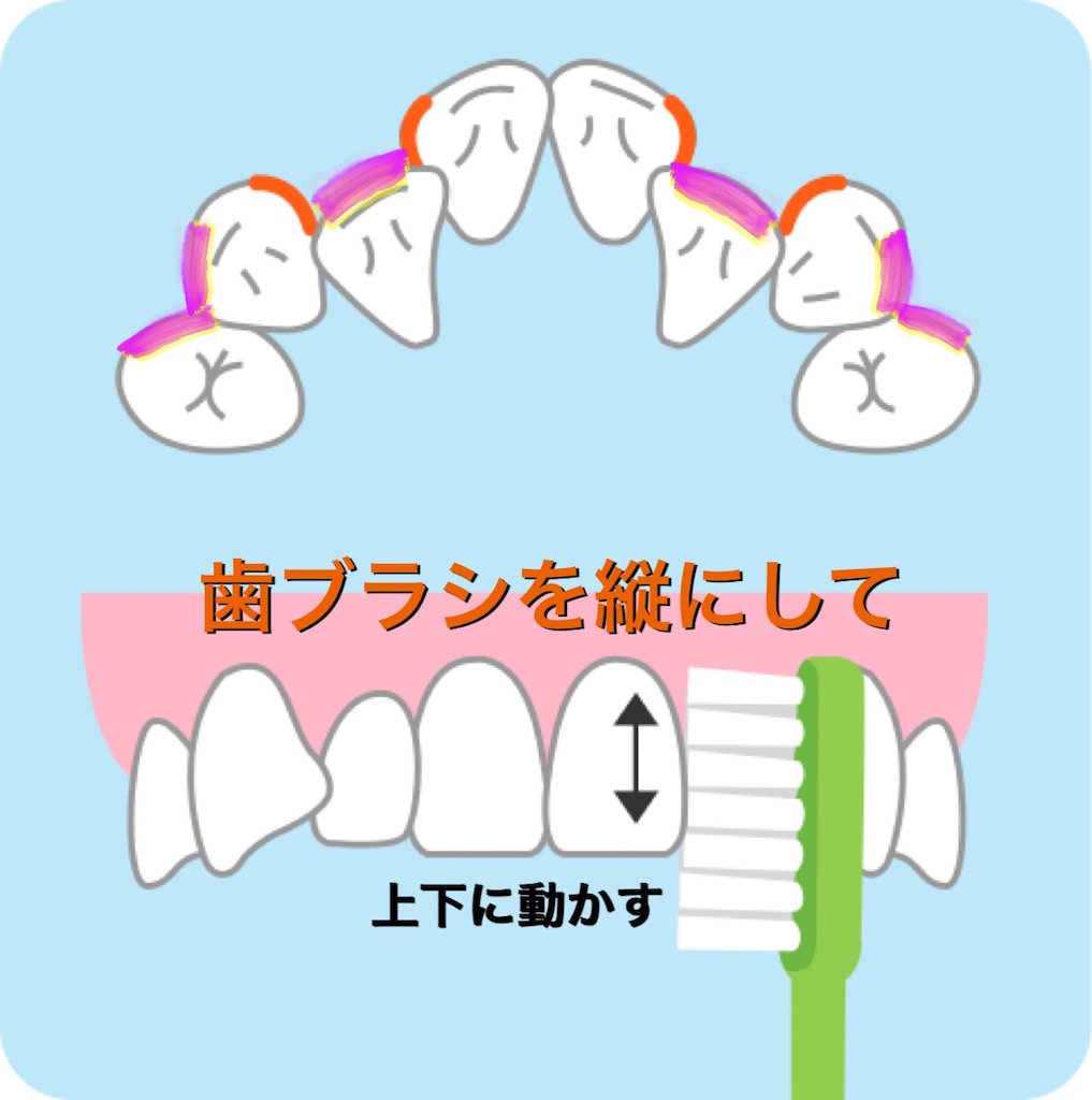 歯磨きの仕方〜ここまですれば口の中が変わるはず〜 - dh-mama’s diary